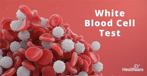 how is the white blood count analyzed in a laboratory|high wbc blood test results.